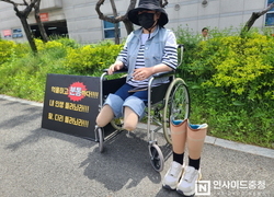 하루아침에 두 손 두 발 모두 잃은 환자의 절규 “억울함을 풀어주세요”